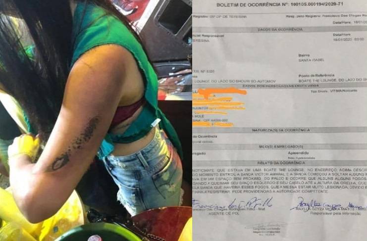 O braço queimado da jovem e o Boletim de Ocorrência registrado na Polícia Civil